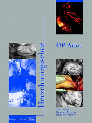cover image of Herzchirurgischer OP-Atlas